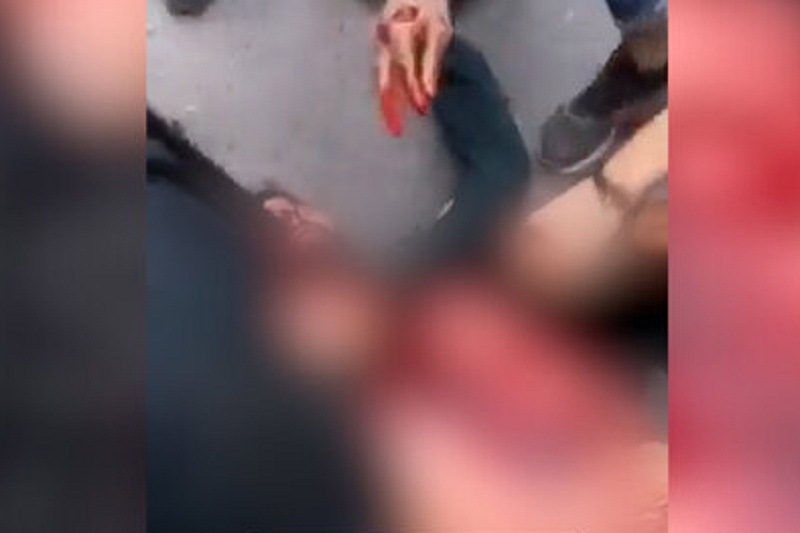 فیلم| بریدن گلوی مامور پلیس در اغتشاشات؛ روایت ماموری که آشوبگران در آمل گلویش را بریدند فیلم| بریدن گلوی مامور پلیس در اغتشاشات؛ روایت ماموری که آشوبگران در آمل گلویش را بریدند | دیلی فوتبال