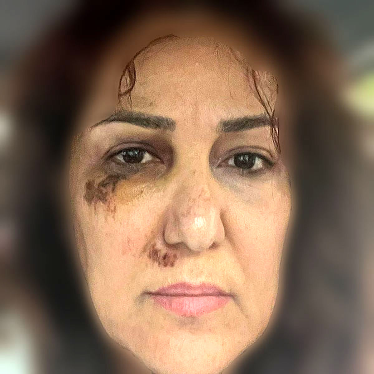 عکس| راز صورت زخمی پانته آ بهرام؛ کشف حجاب و شکنجه یا همدردی با زنان؟ عکس| راز صورت زخمی پانته آ بهرام؛ کشف حجاب و شکنجه یا همدردی با زنان؟ | دیلی فوتبال