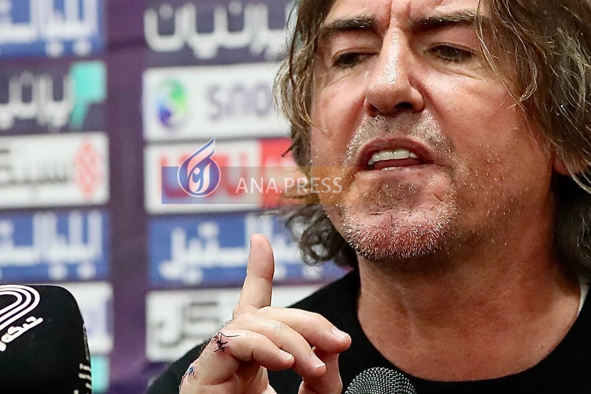 عکس| جراحت شدید ریکاردو ساپینتو؛ بخیه های عجیب روی دست سرمربی استقلال عکس| جراحت شدید ریکاردو ساپینتو؛ بخیه های عجیب روی دست سرمربی استقلال | دیلی فوتبال
