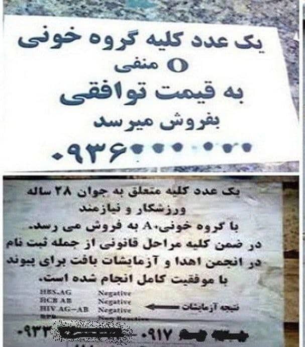 عراقی ها خریدار «کلیه» ایرانیان به قیمت دلار! | دیلی فوتبال