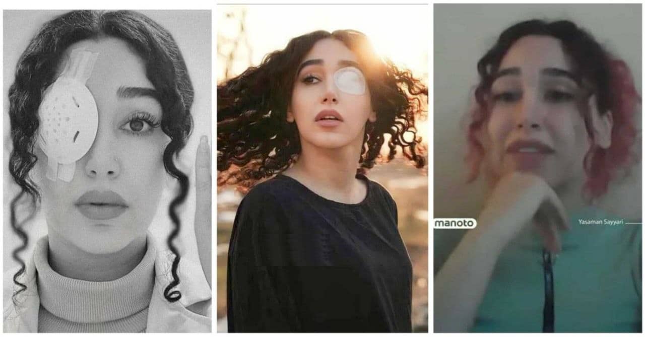 عکس| پس از رشد پاهای حسین رونقی؛ چشم نیلوفر آقایی جوانه زد | دیلی فوتبال