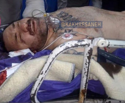 فیلم| هانی کرده؛ از کتک زدن استقلالی ها در ورزشگاه تا درگیری در بهشت زهرا و بیمارستان فیلم| هانی کرده؛ از کتک زدن استقلالی ها در ورزشگاه تا درگیری در بهشت زهرا و بیمارستان | دیلی فوتبال