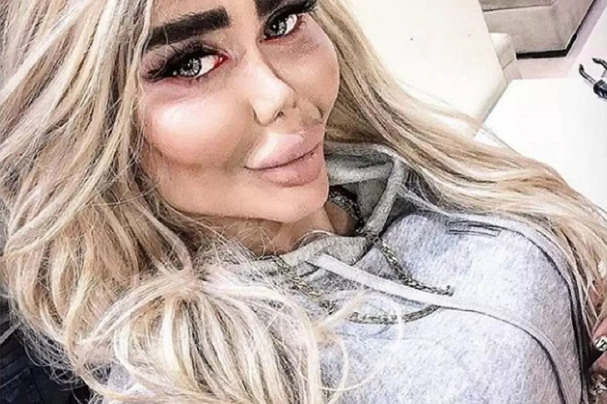 عکس| عاقبت بی حجابی و ترویج فحشا در اینستاگرام عکس| عاقبت بی حجابی و ترویج فحشا در اینستاگرام | دیلی فوتبال