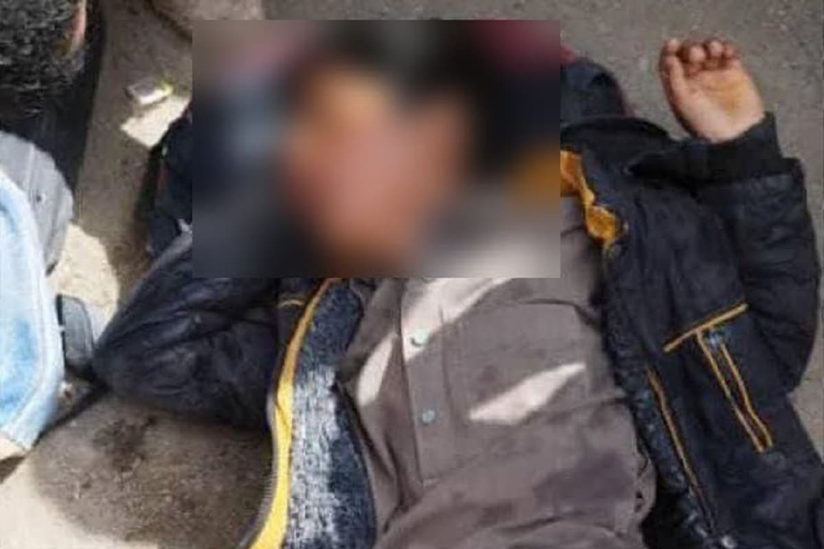 عکس| تنبیه هولناک دانش آموز زاهدانی توسط مدیر مدرسه؛ پسربچه بیهوش به بیمارستان منتقل شد عکس| تنبیه هولناک دانش آموز زاهدانی توسط مدیر مدرسه؛ پسربچه بیهوش به بیمارستان منتقل شد | دیلی فوتبال