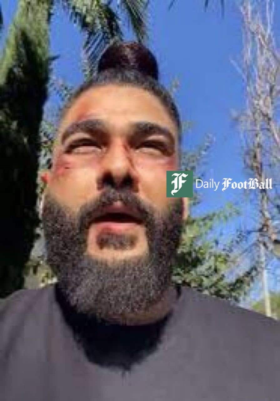 عکس| ضرب و شتم ساسی مانکن توسط نیروهای امنیتی ایران در عمان | دیلی فوتبال