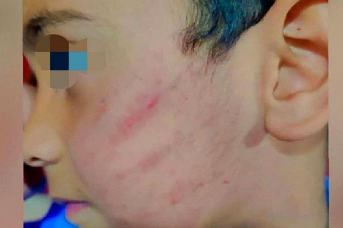 عکس| عاقبت کتک زدن دانش آموز کلاس اولی در سیستان و بلوچستان عکس| عاقبت کتک زدن دانش آموز کلاس اولی در سیستان و بلوچستان | دیلی فوتبال