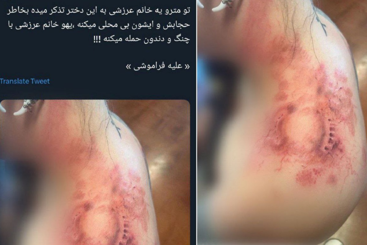 عکس| واقعیت ماجرای گاز گرفتن دختر بی حجاب توسط آمر به معروف در مترو | دیلی فوتبال