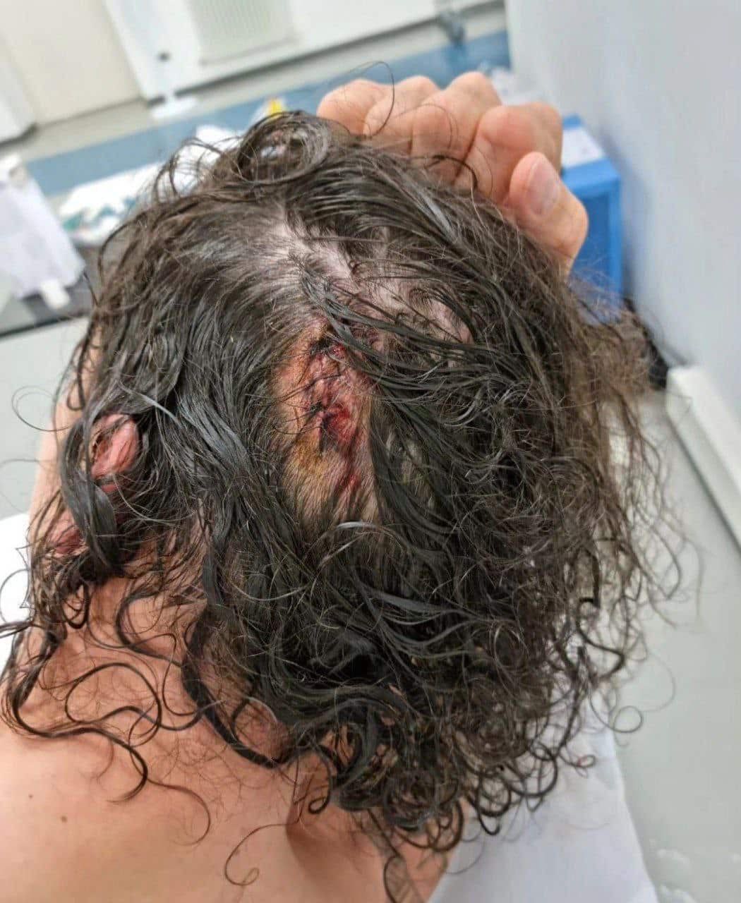 عکس| کتک خوردن و زخمی شدن زلاتان ابراهیموویچ از ناحیه سر عکس| کتک خوردن و زخمی شدن زلاتان ابراهیموویچ از ناحیه سر | دیلی فوتبال