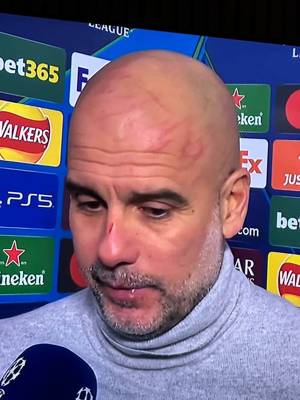 عکس| خودزنی گواردیولا پس از کامبک خوردن در 15 دقیقه | دیلی فوتبال