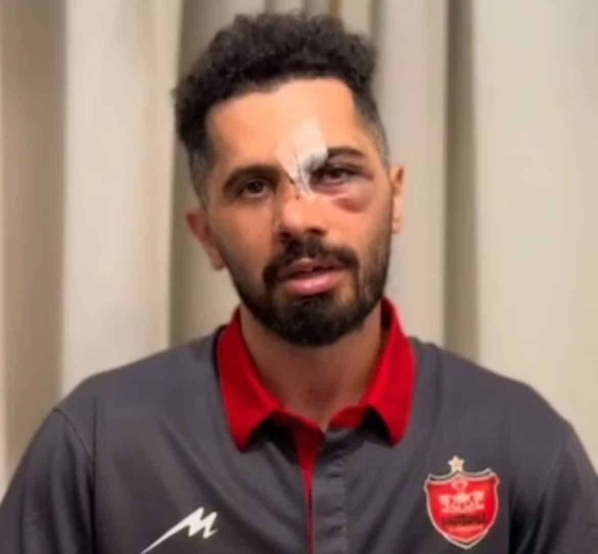 عکس| جدید ترین تصویر از امید عالیشاه پس از مصدومیت | دیلی فوتبال